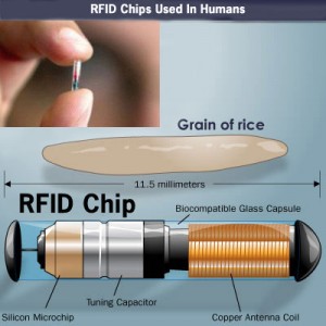 rfid-chip implantaat